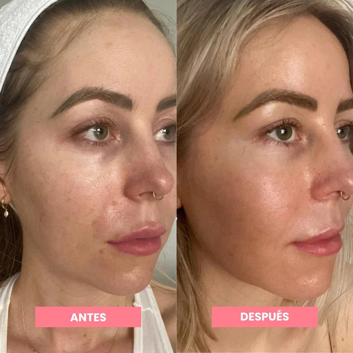 Recupera Tu Juventud: 10 Años Menos para una Piel Radiante y Suave - Dragon's Blood